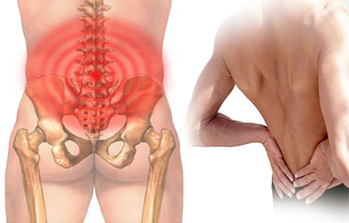 Bệnh Đau thắt lưng: Nguyên nhân, biến chứng và cách điều trị